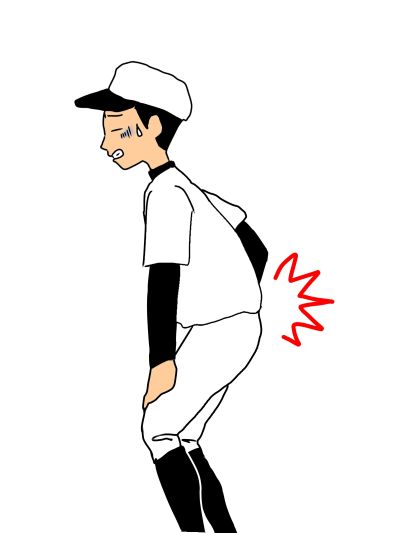 分離すべり症の腰痛1