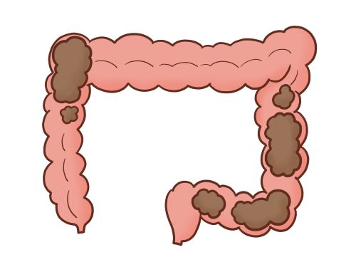 腸活マッサージ１