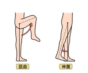 太ももしびれ2