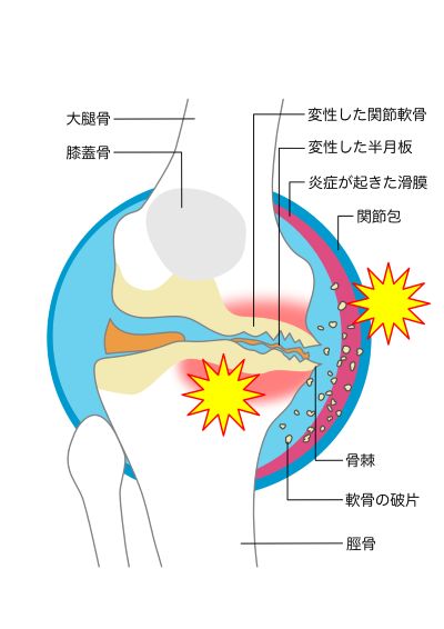 膝の名医1