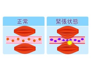 血行促進1