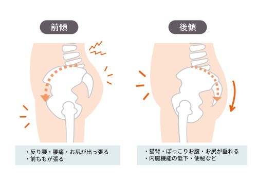 骨盤ダイエット１