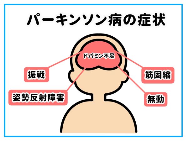 パーキンソン病１