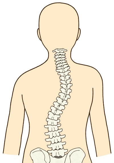 背骨のゆがみ1