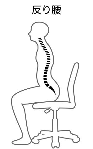 反り腰腰痛２