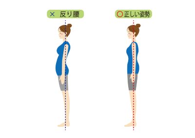 反り腰腰痛４