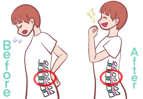 椎間板ヘルニアの名医4