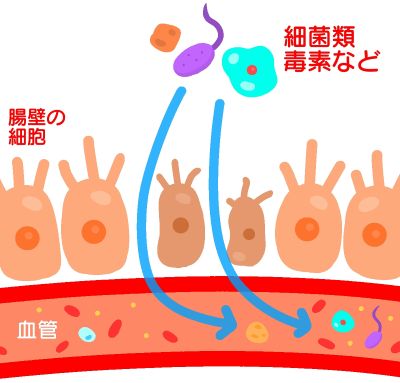 腸漏れ1
